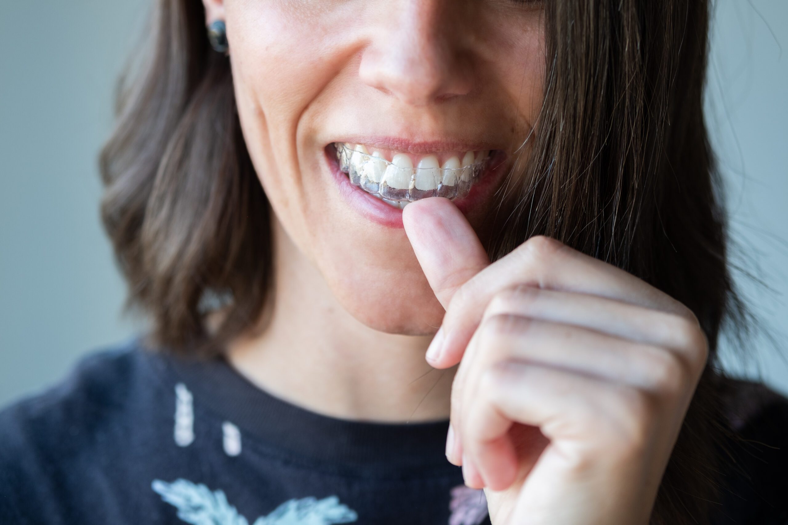 a woman putting on her clear aligner