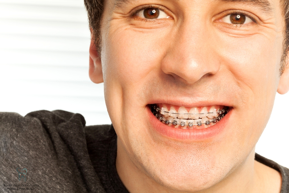 happy young man with metal braces - Overbite vs Underbite in Rocky Point, NY.