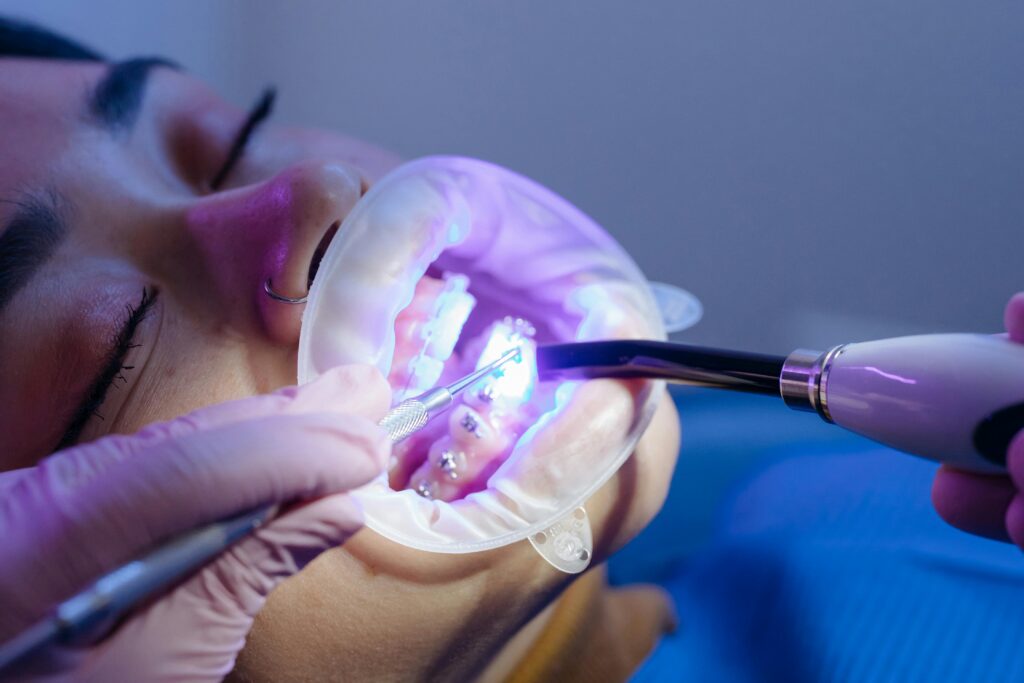 dentist for braces working on patients smile