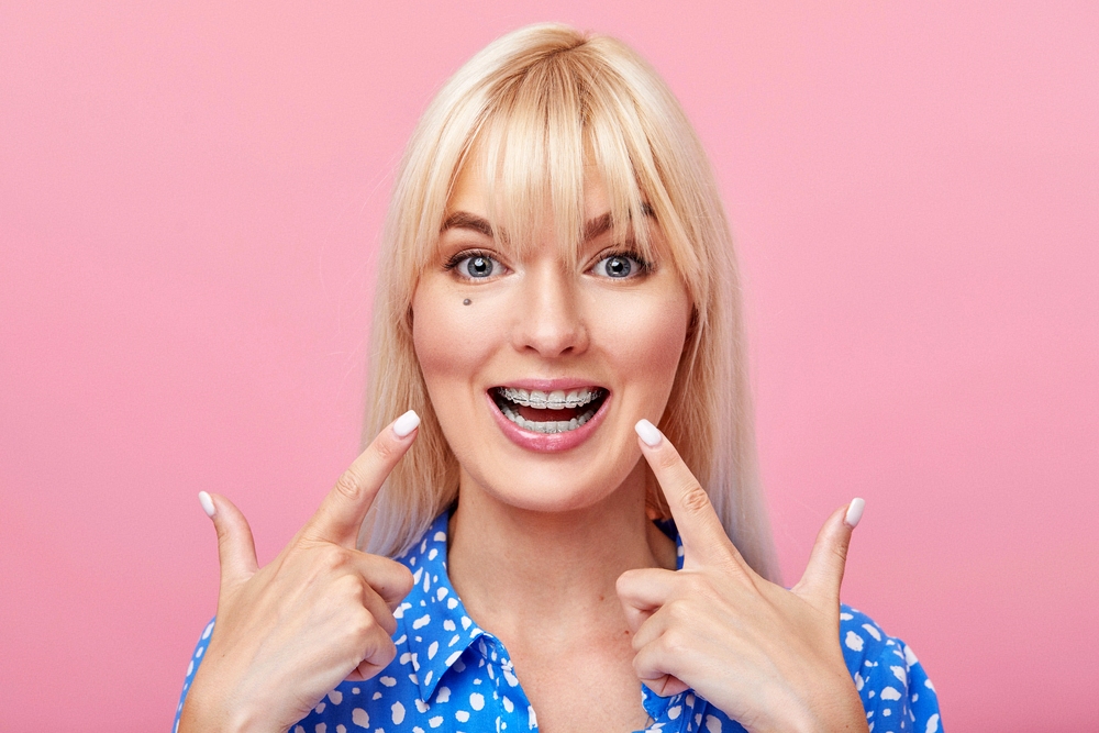 cheerful happy young woman blonde hair gesturing thumb while pointing clear braces - Clear Braces vs. Metal Braces in Rocky Point, NY